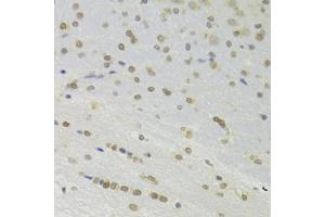 Immunohistochemistry of paraffin-embedded rat brain using DOK1 Antibody (ABIN6130881, ABIN6139763, ABIN6139764 and ABIN6221343) at dilution of 1:100 (40x lens).