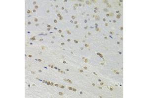 Immunohistochemistry of paraffin-embedded rat brain using DOK1 Antibody (ABIN6130881, ABIN6139763, ABIN6139764 and ABIN6221343) at dilution of 1:100 (40x lens). (DOK1 anticorps  (AA 1-280))