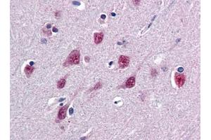 Image no. 1 for anti-Single-Strand-Selective Monofunctional Uracil-DNA Glycosylase 1 (SMUG1) (N-Term) antibody (ABIN372862) (SMUG1 anticorps  (N-Term))