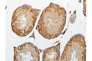IHC analysis of CRB1 using anti-CRB1 antibody (ABIN6719658). (CRB1 anticorps)