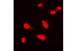 Immunofluorescent analysis of BAP1 staining in Hela cells. (BAP1 anticorps)
