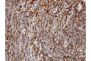 Immunoperoxidase of monoclonal antibody to BAG1 on formalin-fixed paraffin-embedded human tonsil.