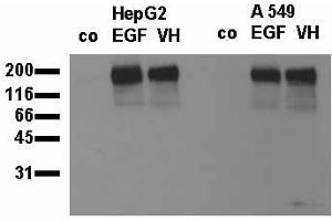 Phosphospecificity: Whole cell extracts of control (co), EGF stimulated (EGF) or pervanadate treated (VH) HepG2 and A549 tumor cells were applied to SDS-PAGE (20,000 cells per lane) and transferred to a PVDF membrane. (EGFR anticorps  (pTyr845))