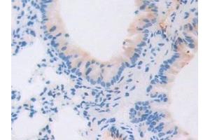 Detection of gp130 in Mouse Lung Tissue using Polyclonal Antibody to Glycoprotein 130 (gp130)