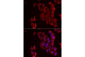 Immunofluorescence analysis of U2OS cells using PAICS antibody. (PAICS anticorps)