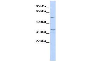 ZNF765 antibody used at 0. (ZNF765 anticorps  (Middle Region))