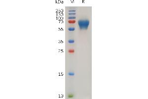 Human LIF Protein, hFc Tag on SDS-PAGE under reducing condition.