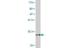 Western Blot detection against Immunogen (32.