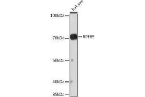 Western blot analysis of extracts of Rat eye, using RPE65 Rabbit mAb (ABIN7269933) at 1:1000 dilution. (RPE65 anticorps)