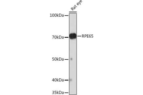 RPE65 anticorps
