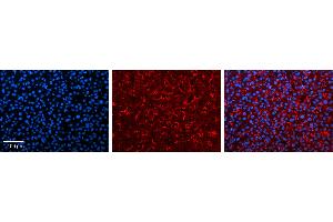 FMO3 antibody - N-terminal region          Formalin Fixed Paraffin Embedded Tissue:  Human Liver Tissue    Observed Staining:  Cytoplasm in sinusoids of liver   Primary Antibody Concentration:  1:100    Secondary Antibody:  Donkey anti-Rabbit-Cy3    Secondary Antibody Concentration:  1:200    Magnification:  20X    Exposure Time:  0.