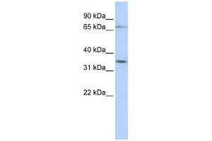 SLCO1C1 antibody used at 1 ug/ml to detect target protein.