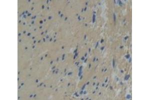 IHC-P analysis of Human Tissue, with DAB staining. (Tropomodulin 1 anticorps  (AA 39-138))
