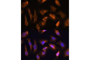 Immunofluorescence analysis of U-2 OS cells using RPS17 antibody (ABIN7270016) at dilution of 1:100.