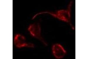 ABIN6276852 staining Hela by IF/ICC. (PTH1R anticorps  (pThr1))