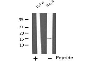 Western blot analysis of extracts from HeLa cells, using IL4 antibody. (IL-4 anticorps  (Internal Region))