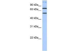 WB Suggested Anti-DLL4 Antibody Titration: 0. (DLL4 anticorps  (N-Term))