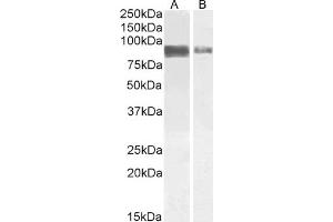 ABIN5539499 (1 μg/mL) staining of Jurkat (A) and (2 μg/mL) A431 (B) cell lysate (35 μg protein in RIPA buffer).