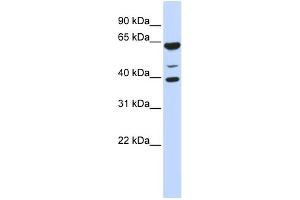 WB Suggested Anti-ZNF764 Antibody Titration: 0. (ZNF764 anticorps  (N-Term))