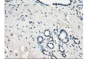 Immunohistochemical staining of paraffin-embedded Ovary tissue using anti-GBP2mouse monoclonal antibody. (GBP2 anticorps)