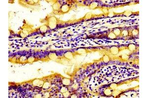 Immunohistochemistry of paraffin-embedded human small intestine tissue using ABIN7170569 at dilution of 1:100 (S1PR2 anticorps  (AA 293-353))