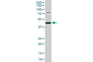 COPS3 polyclonal antibody (A01), Lot # 060113JC01 Western Blot analysis of COPS3 expression in Hela S3 NE .