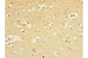 Immunohistochemistry of paraffin-embedded human brain tissue using ABIN7153488 at dilution of 1:100 (GABRA5 anticorps  (AA 32-259))