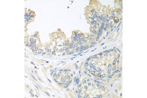 Immunohistochemistry of paraffin-embedded human prostate using CUL3 antibody (ABIN5970436) at dilution of 1/100 (40x lens). (Cullin 3 anticorps)