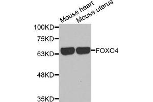 Western blot analysis of extracts of various cell lines, using FOXO4 antibody. (FOXO4 anticorps  (AA 346-505))