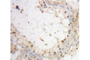 IHC-P analysis of Testis tissue, with DAB staining. (Interleukin enhancer-binding factor 3 (ILF3) (AA 672-891) anticorps)