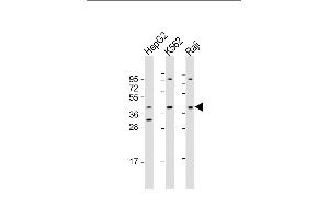All lanes : Anti-FGFR1OP Antibody (Center) at 1:1000-1:2000 dilution Lane 1: HepG2 whole cell lysate Lane 2: K562 whole cell lysate Lane 3: Raji whole cell lysate Lysates/proteins at 20 μg per lane. (FGFR1OP anticorps  (AA 183-214))