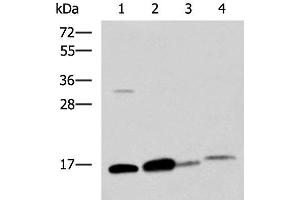 Western blot analysis of Human sigmoid tissue Mouse large intestine tissue Mouse small intestines tissue Mouse Pancreas tissue lysates using ZG16 Polyclonal Antibody at dilution of 1:800 (ZG16 anticorps)