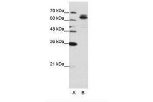 Image no. 1 for anti-Fragile X Mental Retardation, Autosomal Homolog 1 (FXR1) (AA 373-422) antibody (ABIN6736201) (FXR1 anticorps  (AA 373-422))