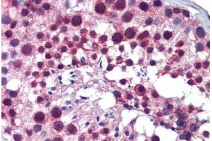 Human Testis: Formalin-Fixed, Paraffin-Embedded (FFPE)