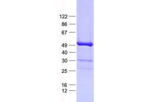 Validation with Western Blot