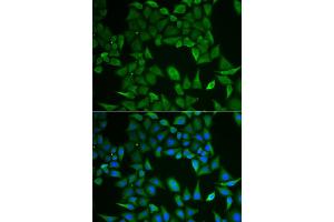Immunofluorescence analysis of HeLa cells using CLPS antibody (ABIN2969055). (CLPS anticorps)
