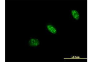 Immunofluorescence of purified MaxPab antibody to PRAF1 on HeLa cell. (POLR1E anticorps  (AA 1-419))