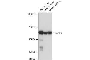 Western blot analysis of extracts of various cell lines, using F Rabbit mAb (ABIN1682600, ABIN3018533, ABIN3018534 and ABIN7101623) at 1:1000 dilution.