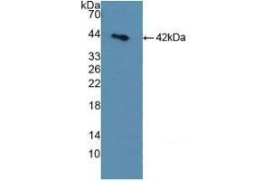 Detection of Recombinant SDH, Rat using Polyclonal Antibody to Sorbitol Dehydrogenase (SDH) (SORD anticorps  (AA 2-357))