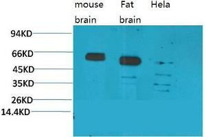 Western Blot (WB) analysis of 1) Mouse Brain Tissue, 2)Rat Brain Tissue, 3)Human Brain Tissue, with CCKBR Rabbit Polyclonal Antibody diluted at 1:2000. (CCKBR anticorps)