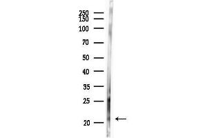 anti-Teratocarcinoma-Derived Growth Factor 1 (TDGF1) (Internal Region) antibody