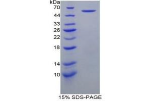 SDS-PAGE of Protein Standard from the Kit (Highly purified E. (HSPD1 Kit ELISA)
