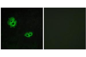 Immunofluorescence analysis of MCF-7 cells, using GPR171 antibody. (GPR171 anticorps  (Internal Region))