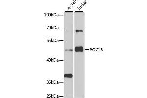 Western blot analysis of extracts of various cell lines, using POC1B antibody (ABIN6132854, ABIN6145868, ABIN6145869 and ABIN6223533) at 1:1000 dilution. (POC1B anticorps  (AA 299-478))