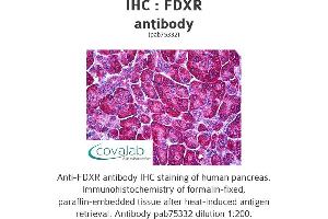 Image no. 1 for anti-Ferredoxin Reductase (FDXR) antibody (ABIN1734312) (Ferredoxin Reductase anticorps)