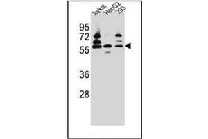Western blot analysis of PDP1 Antibody (Center) in Jurkat,HepG2,293 cell line lysates (35ug/lane). (PDP anticorps  (Middle Region))