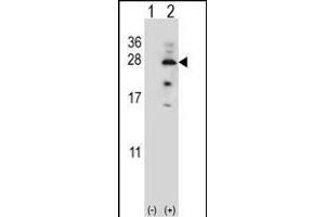 Western blot analysis of IL17B (arrow) using rabbit polyclonal IL17B Antibody (Center) (ABIN655941 and ABIN2845330). (IL17B anticorps  (AA 39-66))