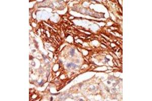 Image no. 1 for anti-V-Raf Murine Sarcoma 3611 Viral Oncogene Homolog (ARAF) (Middle Region) antibody (ABIN360127) (ARAF anticorps  (Middle Region))