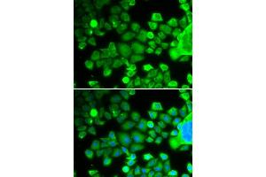 Immunofluorescence analysis of MCF-7 cells using RPS10 antibody (ABIN6132945, ABIN6147192, ABIN6147194 and ABIN6221686). (RPS10 anticorps  (AA 1-165))