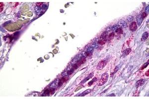 Anti-SMO antibody IHC staining of human placenta, cytotrophoblast. (SMO anticorps)